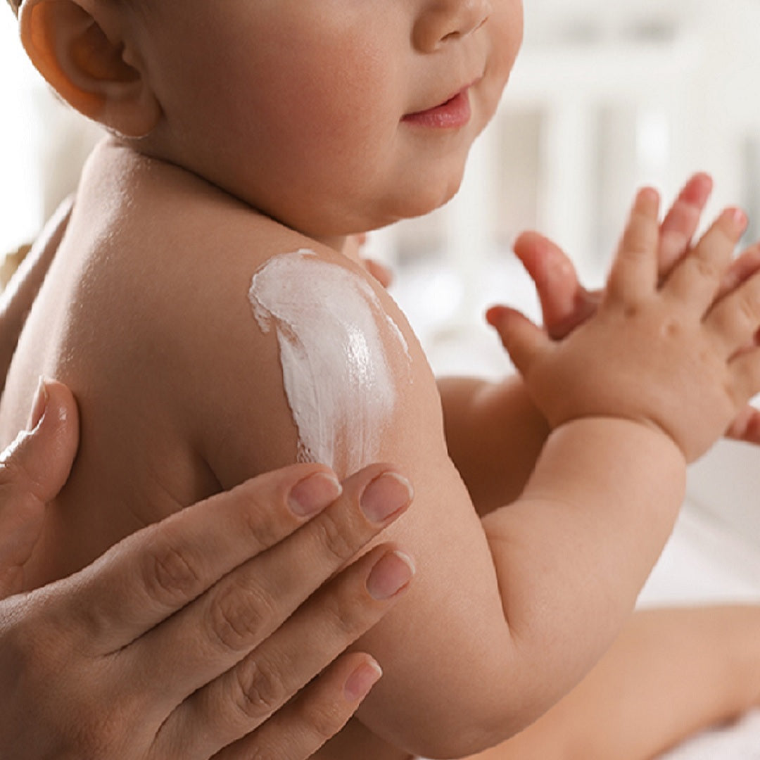 Best cream for baby eczema